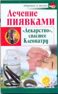 Лечение пиявками