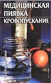Медицинская пиявка. Кровопускание