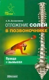 Отложение солей в позвоночнике. Правда и вымысел