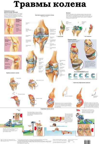 Травмы колена. Остеопороз - фото 1
