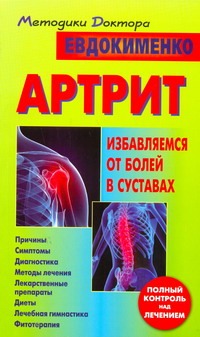 Артрит : избавляемся от болей в суставах