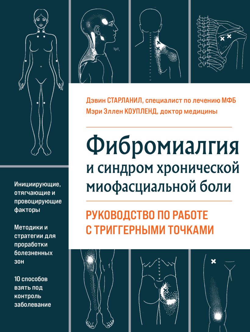 Лечение миофасциальной боли клиническое руководство люси уайт фергюсон роберт гервин